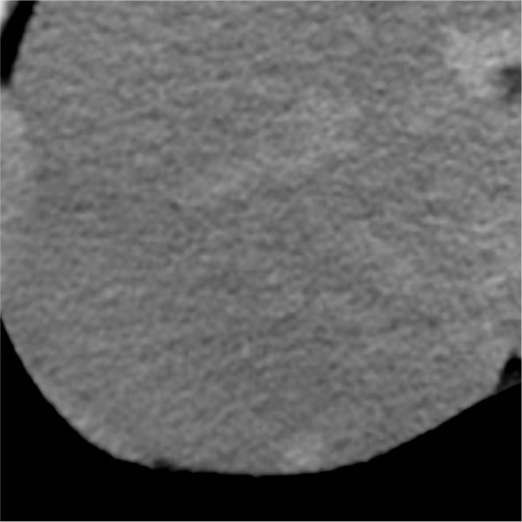 Fig. 1. Simple CT