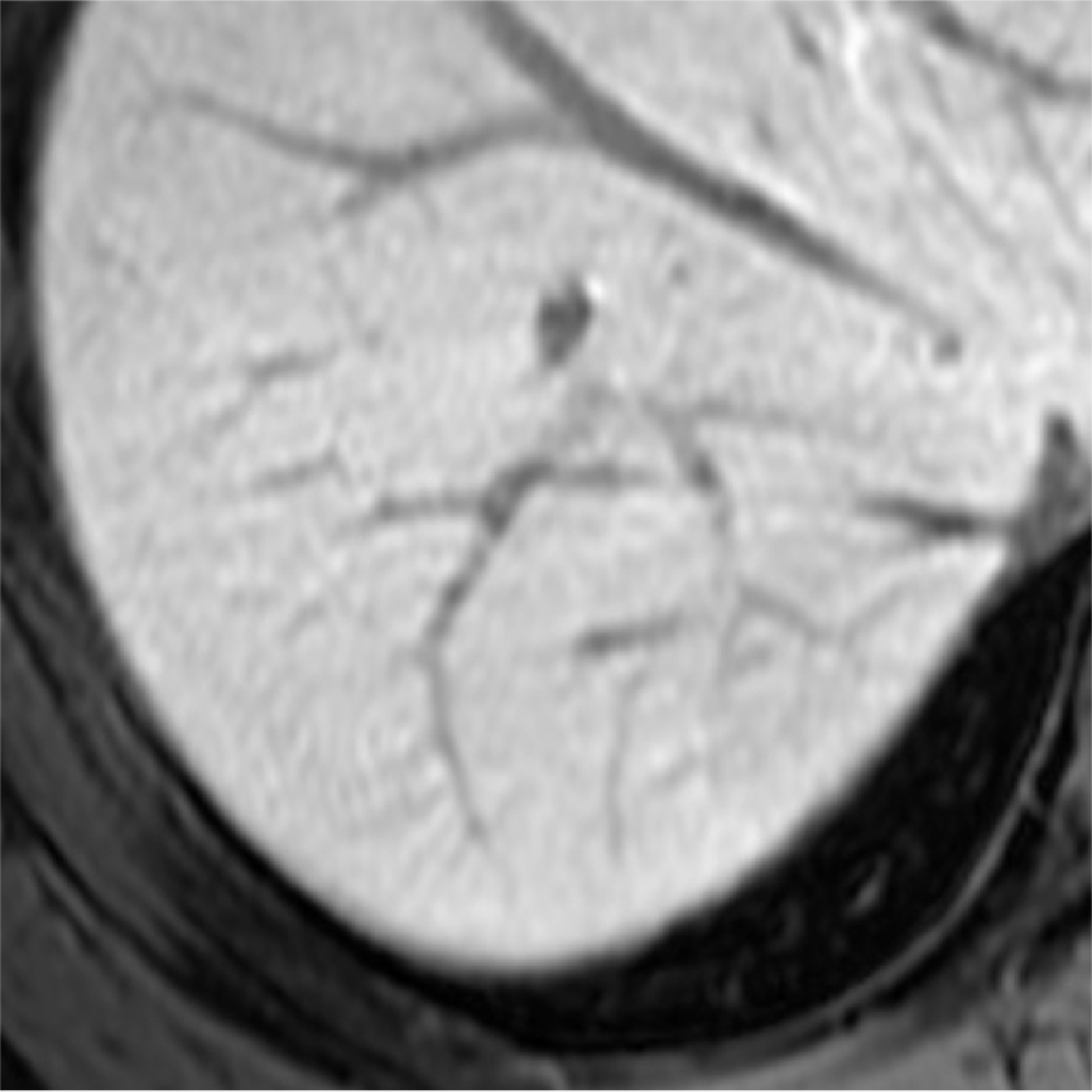 Fig. 5. Hepatobiliary phase