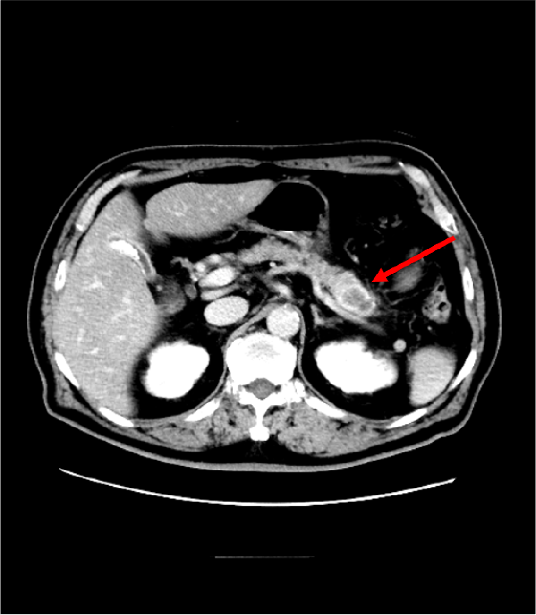Fig. 1. Dynamic CT equilibrium phase