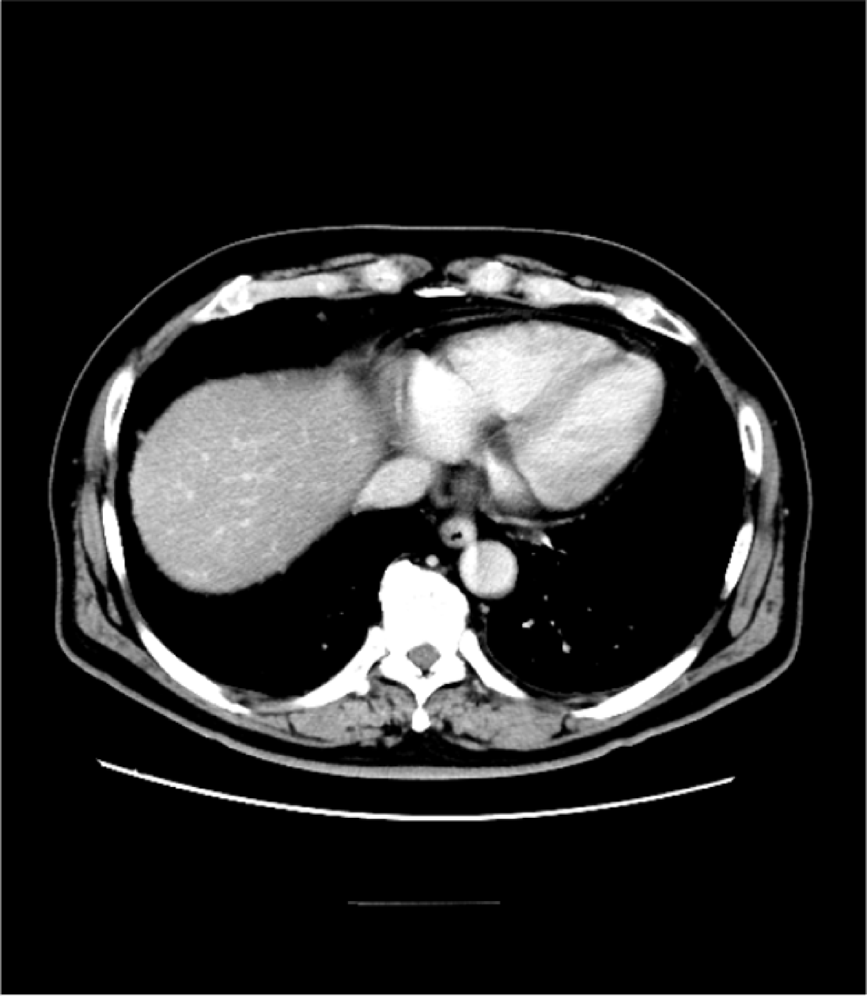 Fig. 1. Dynamic CT equilibrium phase