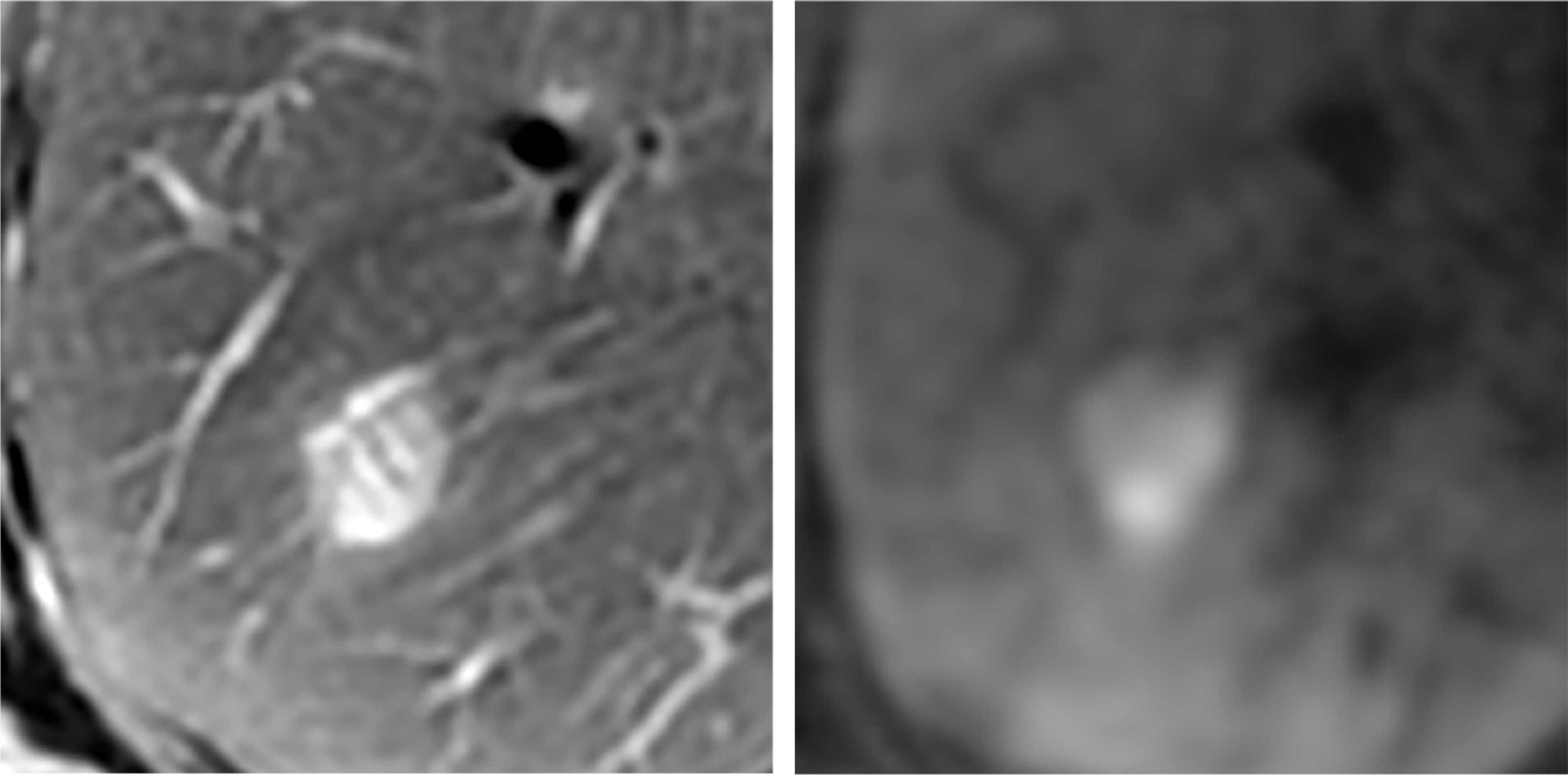 Fig. 1. T2- and diffusion-weighted imaging